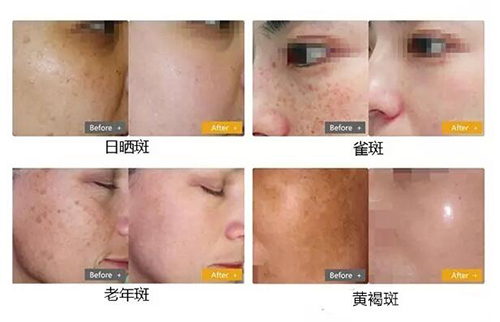 ���}Ƥ�w�K�Y��&mdash;&mdash;��Ƥ�뼤��1064QVYH