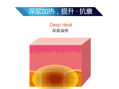 ������LTV-FD+���מ�ʲô�@ô��