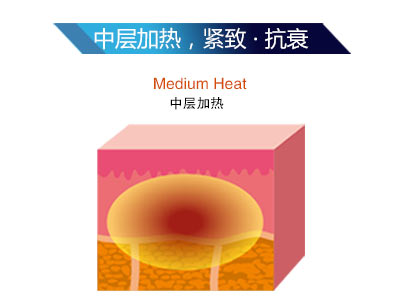 ������LTV-FD+���מ�ʲô�@ô��